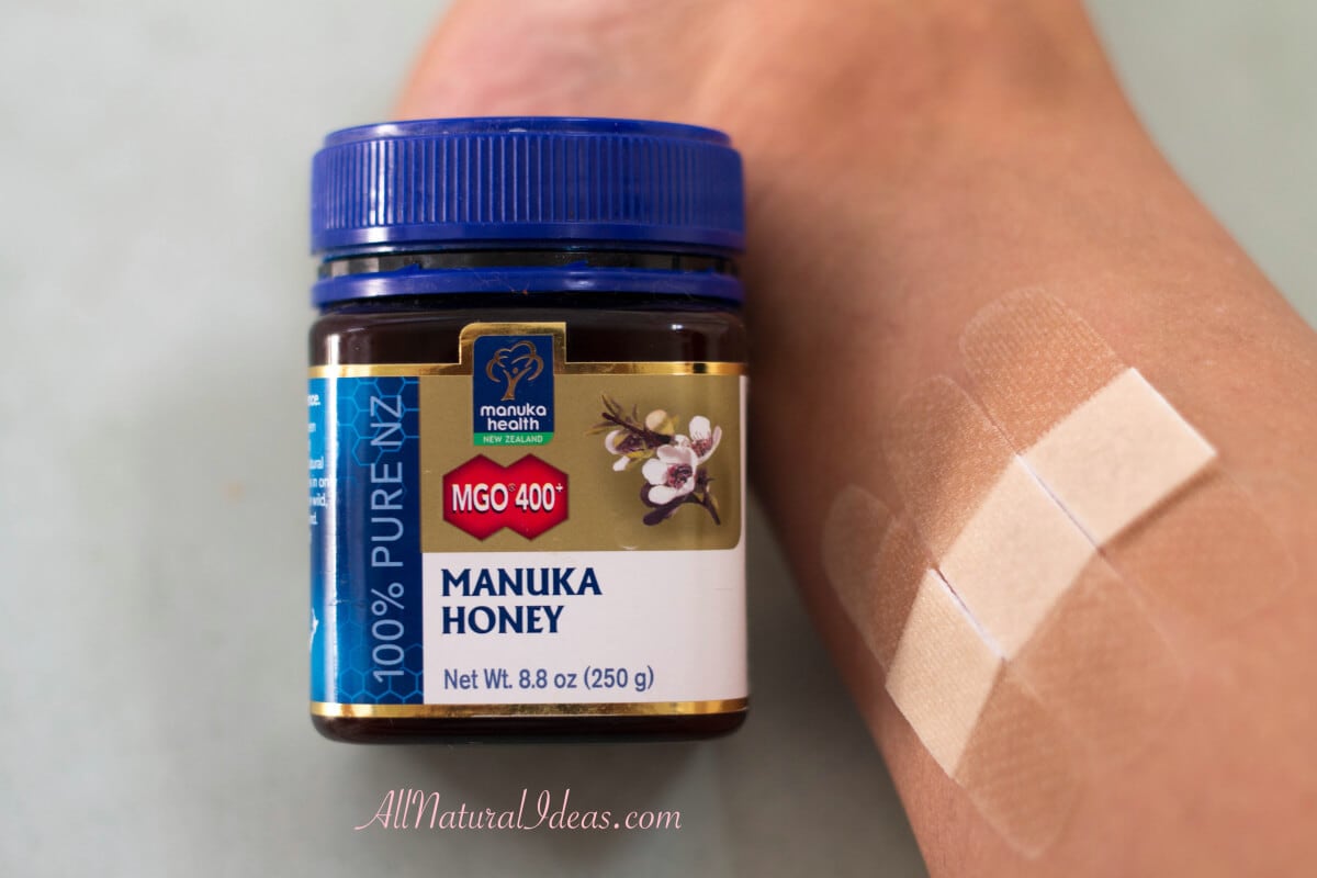 Manuka honey to treat skin wounds quickly