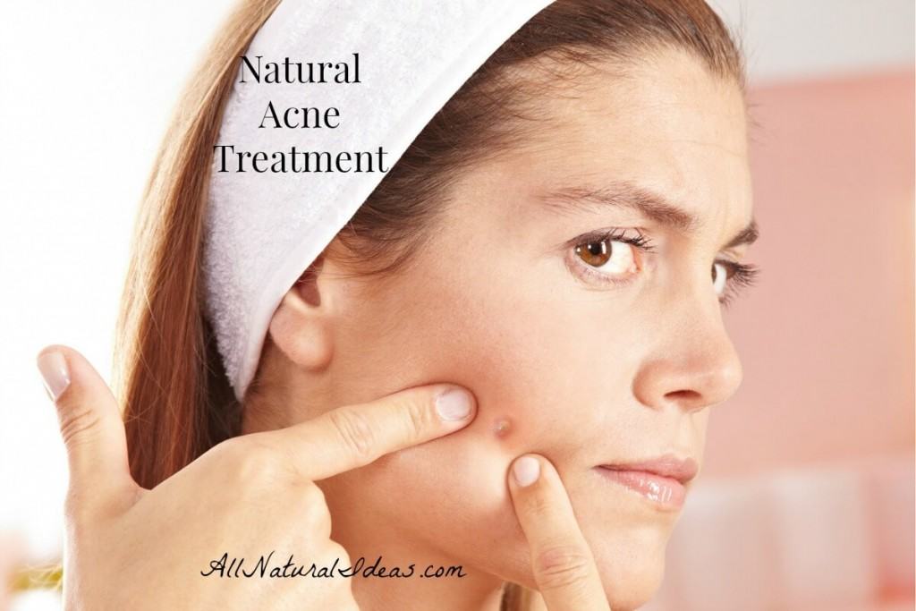 Natural acne treatment for clear skin