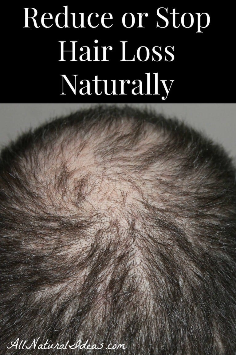 Reduce Hair Loss Naturally All Natural Ideas