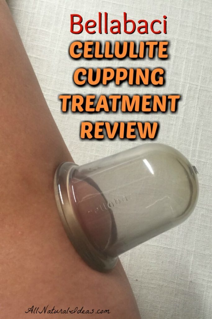 What's the best natural cellulite treatment? Cupping is certainly at the top. Read our Bellabaci cups review for the cellulite cupping treatment.