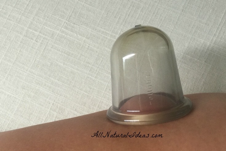 Bellabaci cellulite cupping treatment review