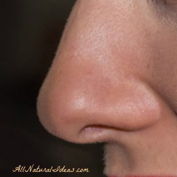 How to get rid of blackheads on nose