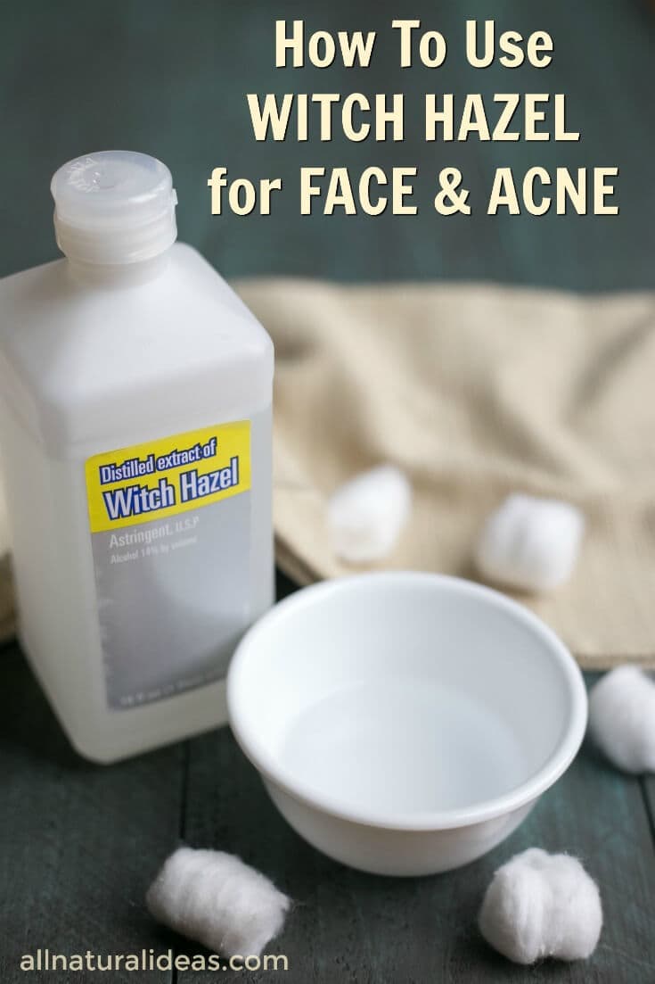 Witch hazel uses for face include treating acne. But, did you know that this topical solution can be used for more beauty routines? | allnaturalideas.com