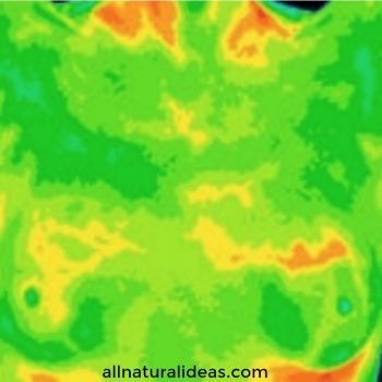 Thermography scan closeup