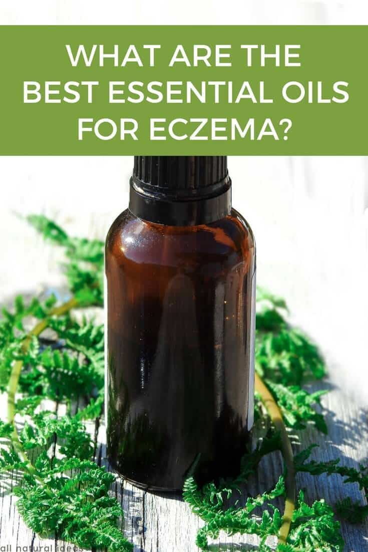 What are the best essential oils for eczema?