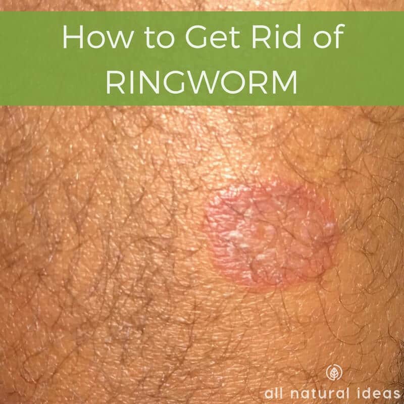 how long does it take for ringworm to go away