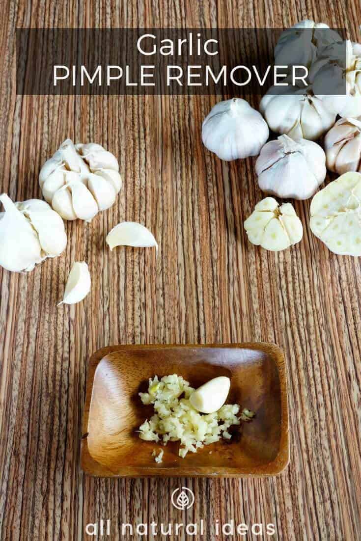 Garlic pimple remover for clearer skin