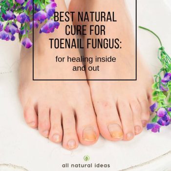 Looking for the best natural cure for toenail fungus? Think about treating it from the inside out, too.